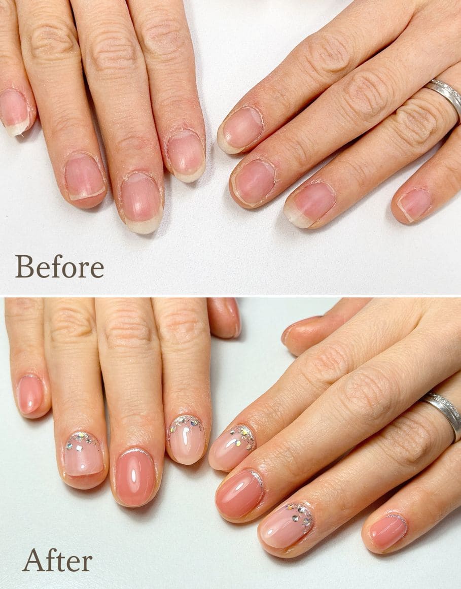 草津市 uluca nail は薄い爪・二枚爪・反り爪などお悩みに対応